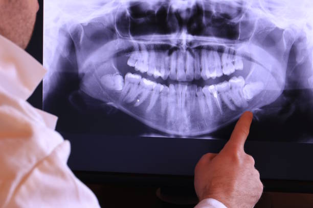 Best Broken or Cracked Tooth Emergency Dentist in Spring Valley, NY